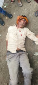 कुत्ते से टकराकर स्कूटी सवार युवक गंभीर घायल, पहचान में जुटी पुलिस